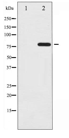 PRKCD / PKC-Delta Antibody (phospho-Tyr64)