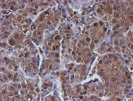 PSMB9 Antibody (clone OTI3F3)