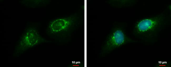 RGS7 Antibody (aa44-412)