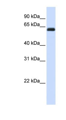 Polyclonal Rabbit anti-Human KIRREL2 / FILTRIN Antibody (aa72-121, WB)