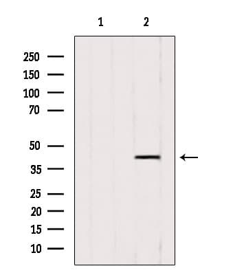 Polyclonal Rabbit anti-Human ACAA1 Antibody (IHC, WB)