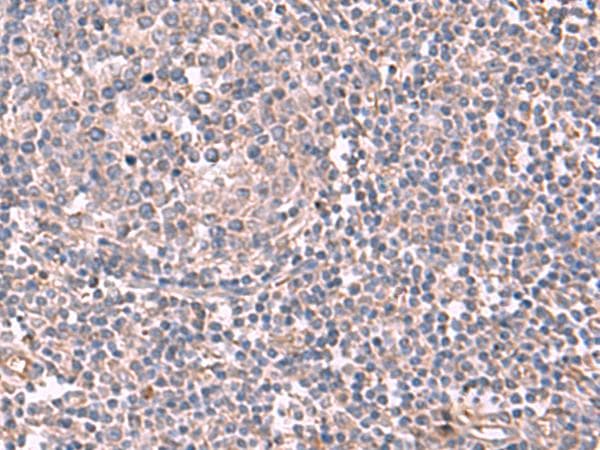 JAZF1 Antibody