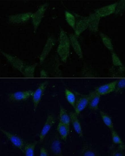 Polyclonal Rabbit anti-Human ZWINT Antibody (IF)