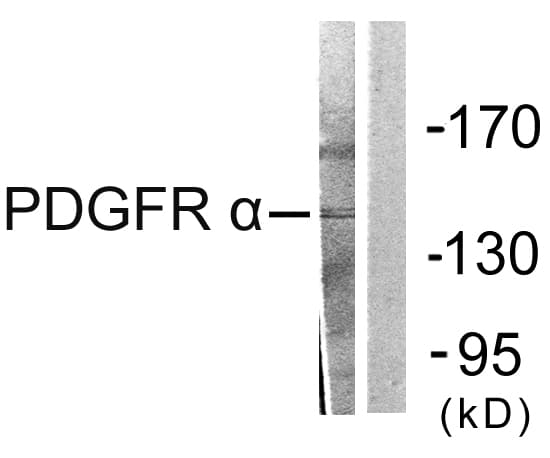 PDGFRA / PDGFR Alpha Antibody (aa1031-1080)