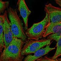 Monoclonal Mouse anti-Human NR3C1/Glucocorticoid Receptor Antibody (clone 6000000, IHC, IF, WB)