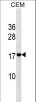ADM2 / Adrenomedullin 2 Antibody (aa15-42)