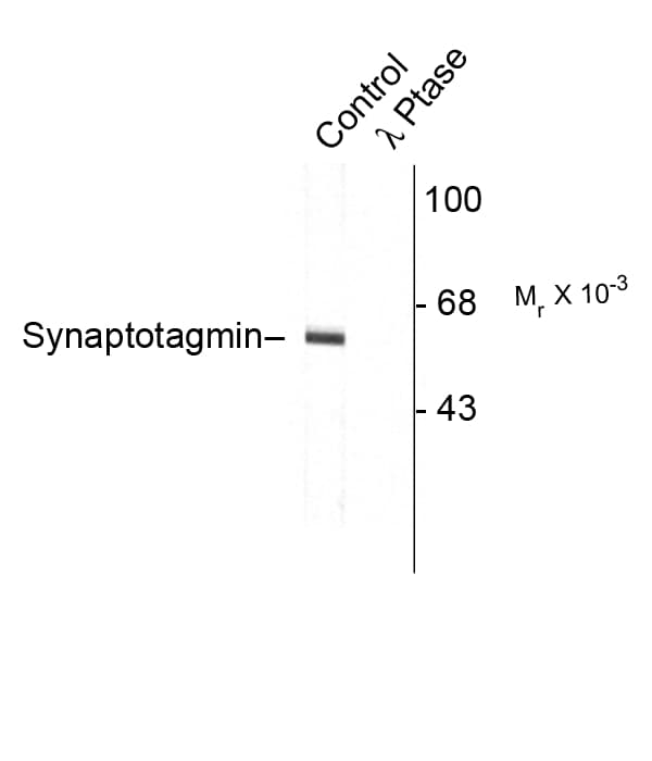 Polyclonal Rabbit anti-Rat SYT1 / Synaptotagmin Antibody (phospho-Thr202, WB)