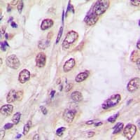 EIF2AK1 Antibody