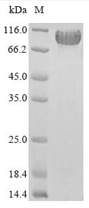Aspergillus kawachii eglD Protein (Recombinant 6His, N-terminus)