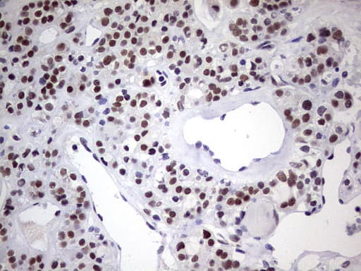 C14orf166 Antibody (clone OTI4B1)