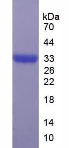 Human ASAH1 / Acid Ceramidase Protein (Recombinant His)