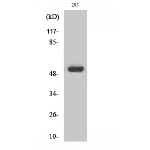 Polyclonal Rabbit anti-Human MMP1 Antibody (190-270 aa, Internal, WB)