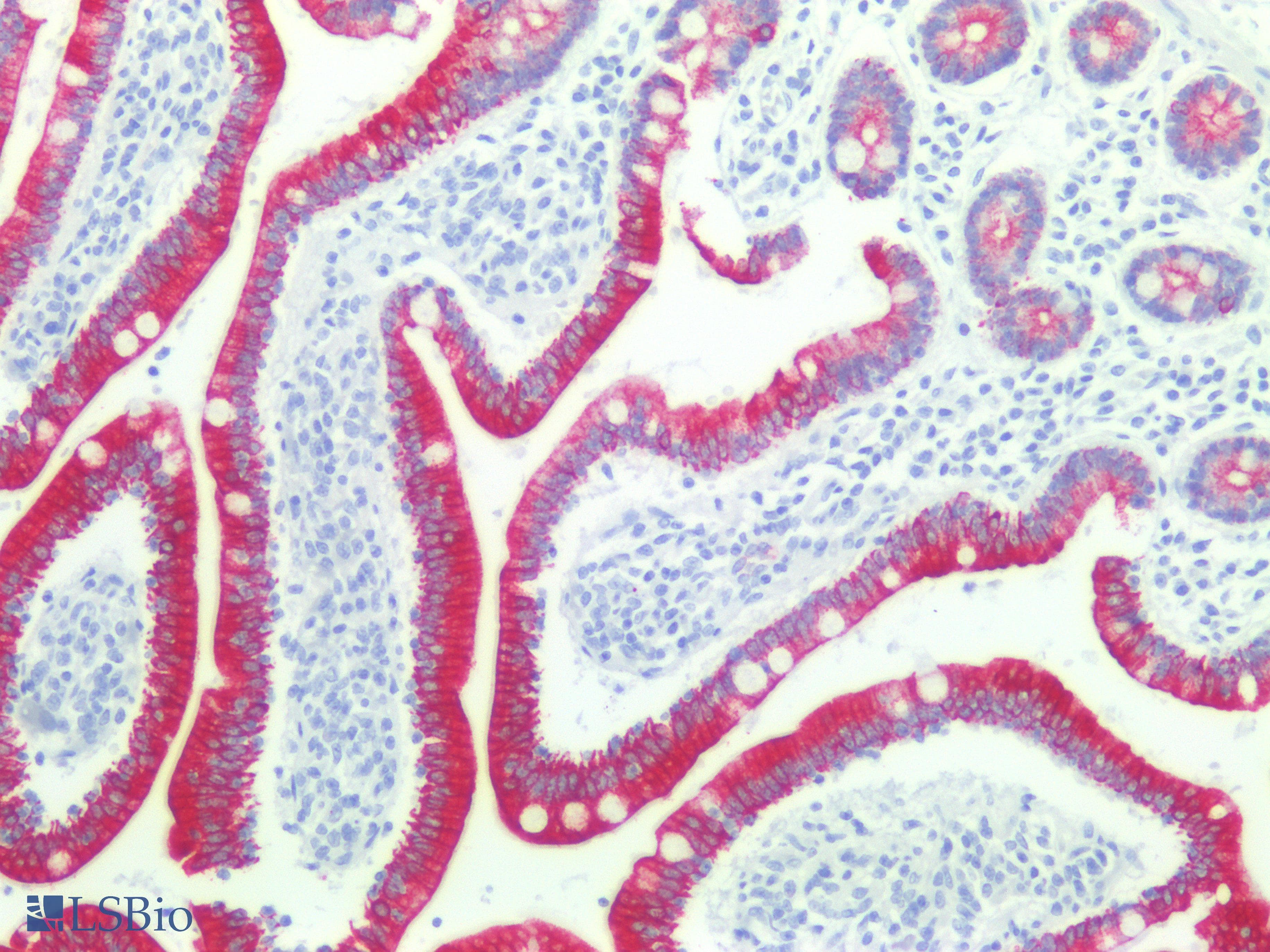 PathPlus™ KRT8 / CK8 / Cytokeratin 8 Antibody