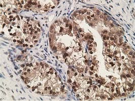 ADH2 / ADH1B Antibody (clone OTI4F12)