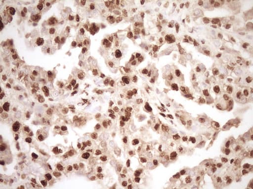 SAE1 Antibody (clone OTI6C7)
