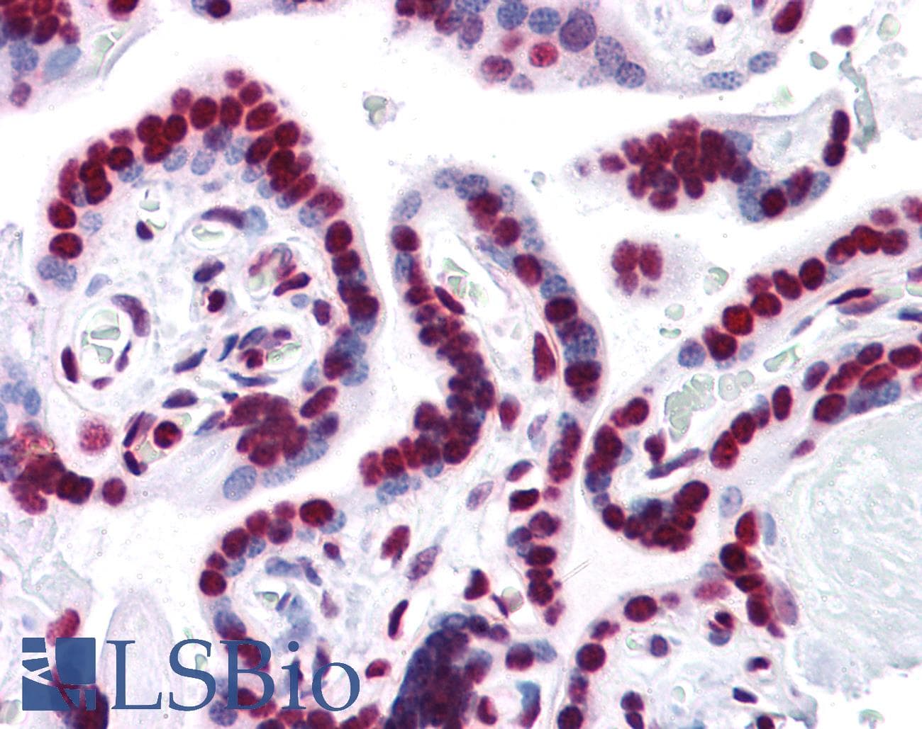 IHC-plus™ HMG1 / HMGB1 Antibody (clone 1D5)