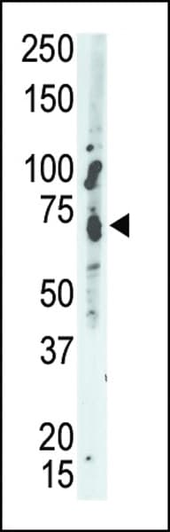 Polyclonal Rabbit anti-Human PTPN9 / MEG2 Antibody (aa477-505, IHC, WB)