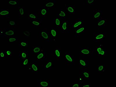 HIST1H1E Antibody