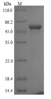 Human FBXL2 Protein (Recombinant 6His, N-terminus)