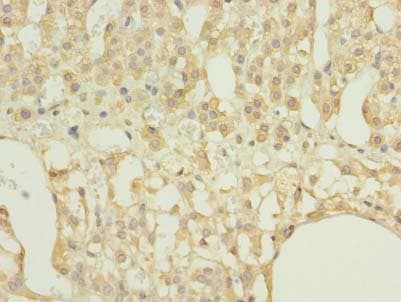 IHC-plus™ RAP1A Antibody