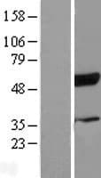 RBCK1 Protein (Over-Expression Lysate Myc-DDK (Flag))
