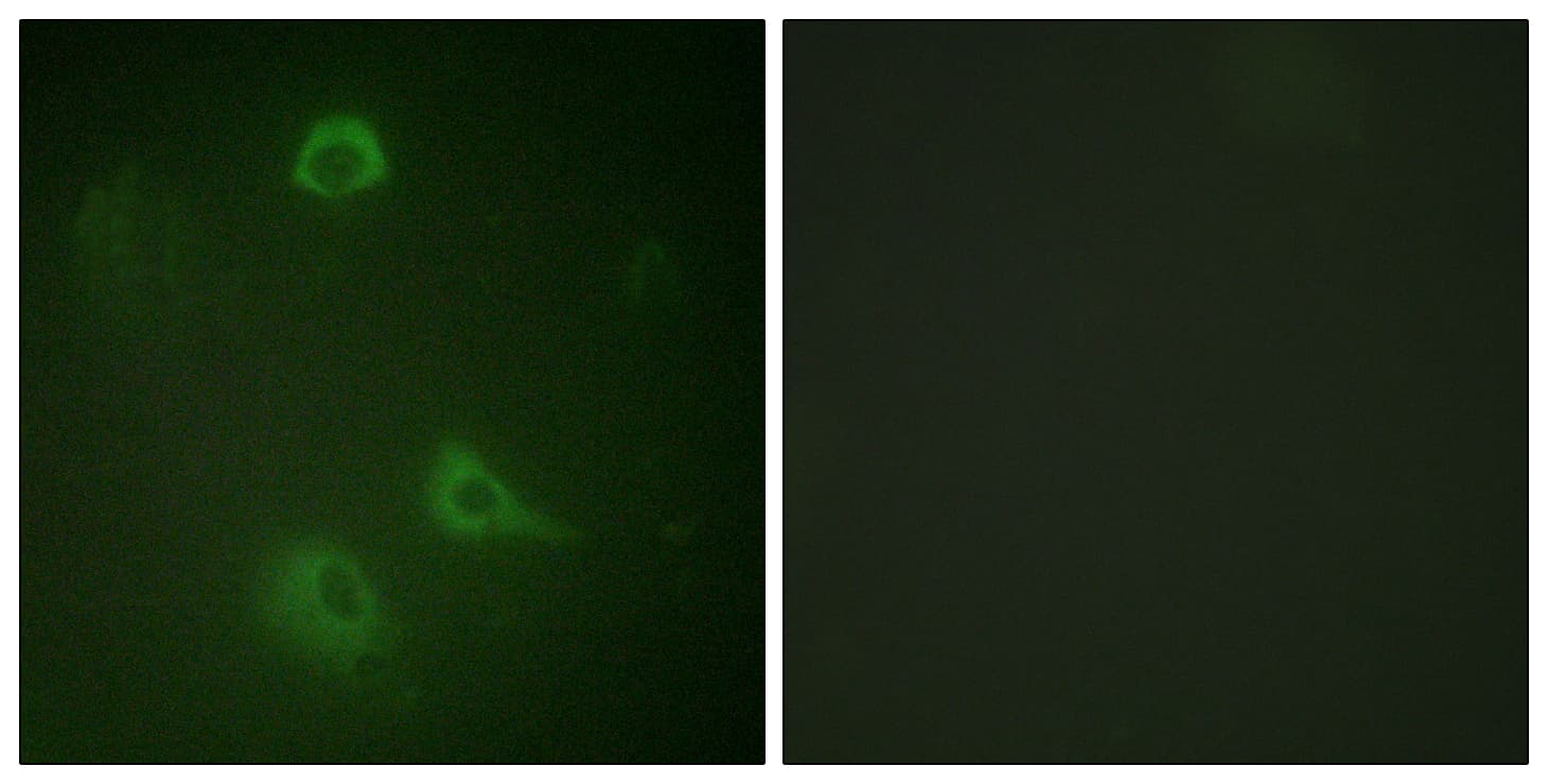 GRIN1 / NMDAR1 Antibody (phospho-Ser890)