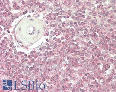 IHC-plus™ IL7R / CD127 Antibody