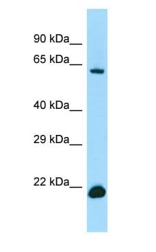 IRF2BP2 Antibody (aa412-461)
