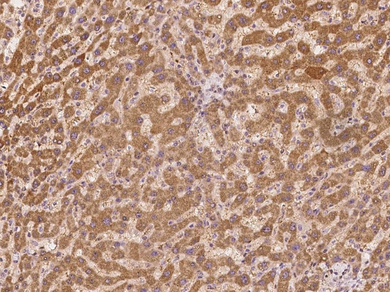 Polyclonal Rabbit anti-Human SECISBP2L Antibody (IHC)