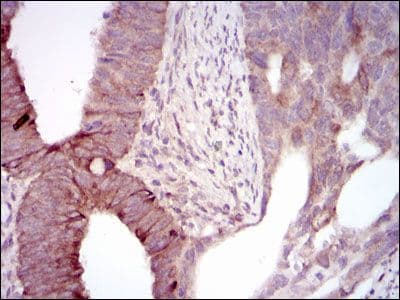 MELK Antibody (Amino Acid: 637-651:C-VYKRLVEDILSSCKV, clone 2G2)