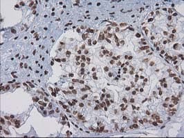 CTDSP1 / SCP1 Antibody (clone OTI1B6)
