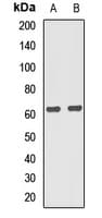 PPP2R5C Antibody