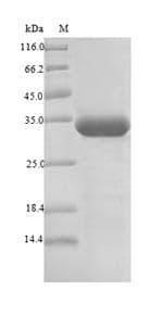 Pyrococcus furiosus Putative L-asparaginase Protein (Recombinant 6His-SUMO, N-terminus)