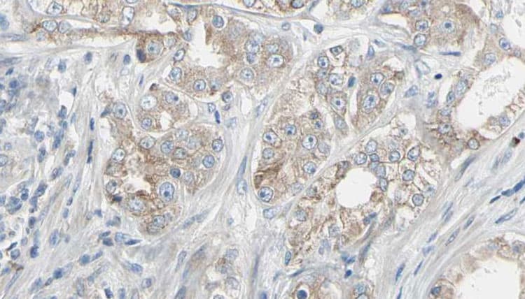 GSPT1 Antibody