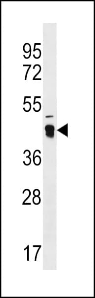 ATAD3C Antibody (aa146-172)