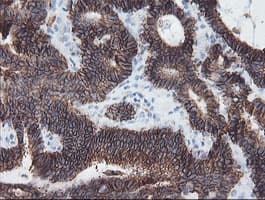 SRPRB Antibody (clone OTI1D9)