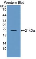 PDGF-BB Antibody (aa82-190)