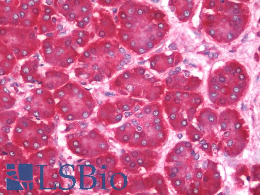 IHC-plus™ RPL8 / Ribosomal Protein L8 Antibody