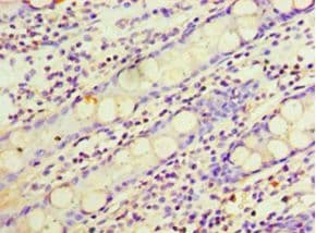 ARL4D Antibody