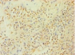 CASP1 / Caspase 1 Antibody