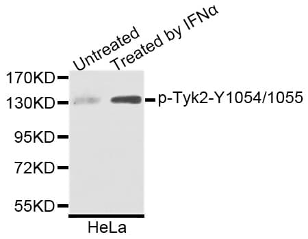 TYK2 Antibody (phospho-Tyr1054/1055)