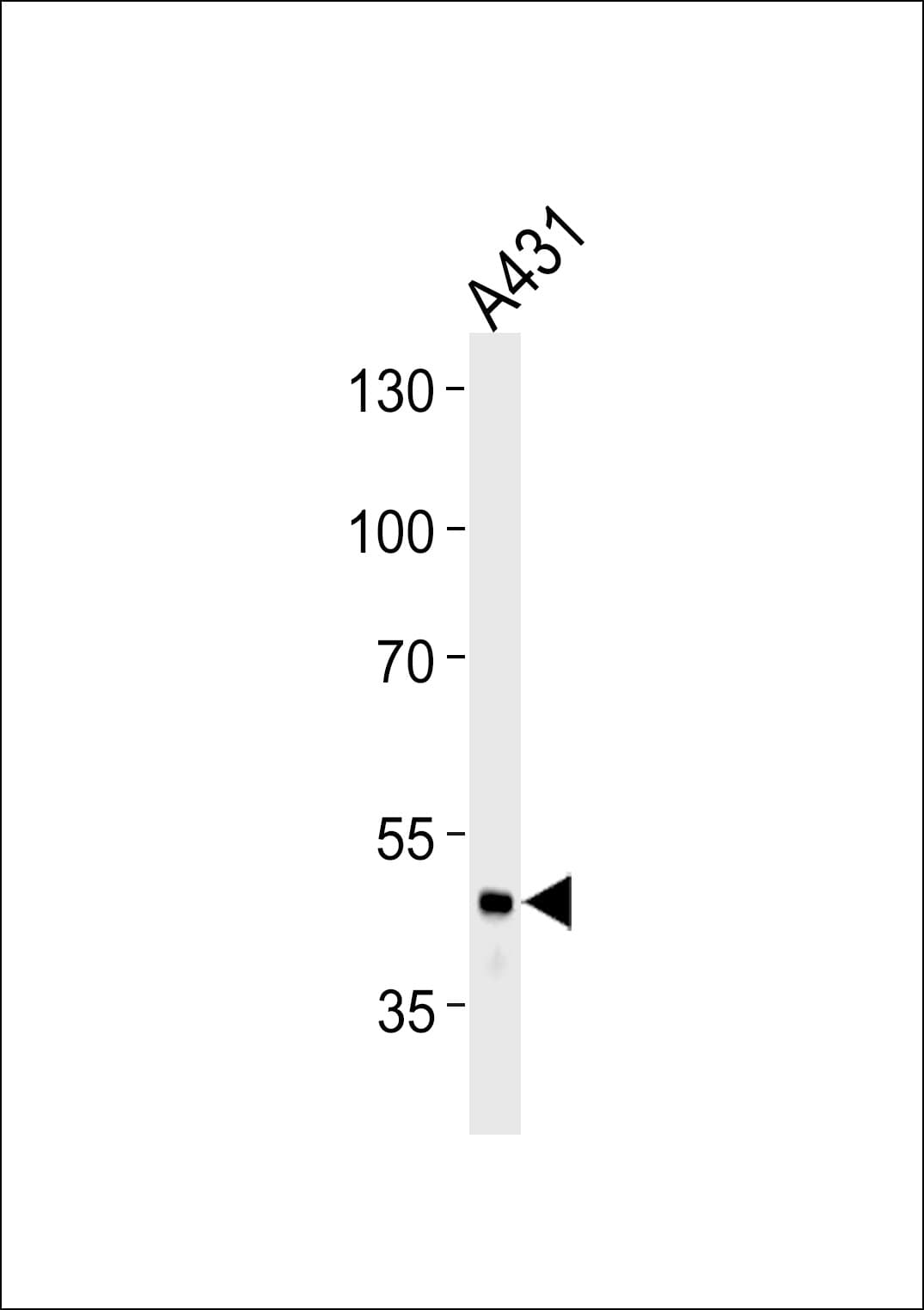 FGG / Fibrinogen Gamma Antibody (aa91-118)