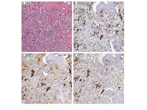 AHSP / EDRF Antibody (Liquid)