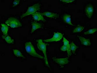 Polyclonal Rabbit anti-Human MPST Antibody (IHC, IF)