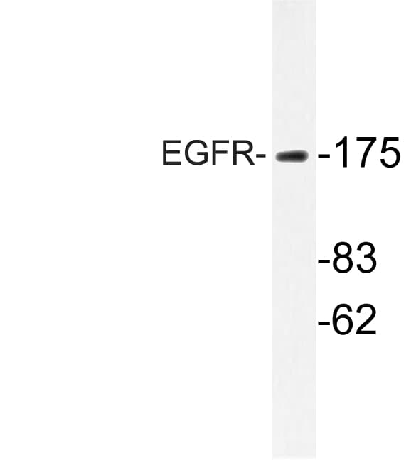 EGFR Antibody (Ser1104)