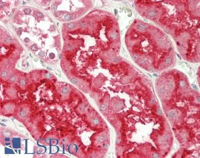 IHC-plus™ PIGF Antibody (C-Terminus)