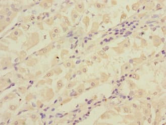 Polyclonal Rabbit anti-Human RCHY1 / PIRH2 Antibody (IHC)