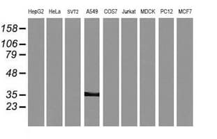 KIF25 Antibody (clone OTI2F4)