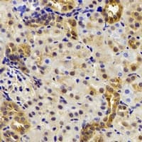 Polyclonal Rabbit anti-Human DDX39 Antibody (IHC, WB)