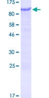 Human LIMD1 Protein (Recombinant GST)